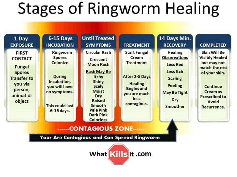 Stages of Ringworm Healing See What Stage You're In and What's Next